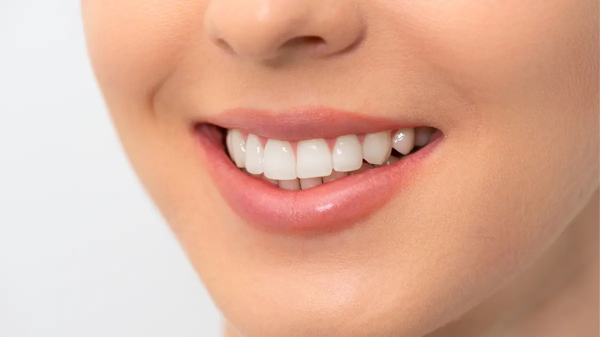 Como ter um sorriso perfeito